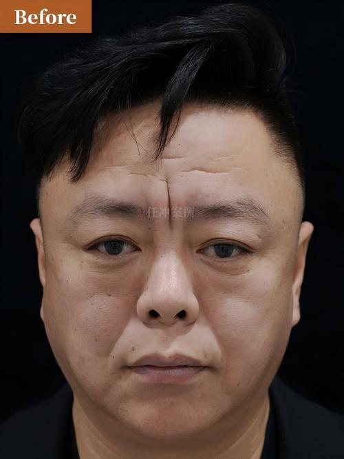 惠民24小时在线套医保微信能用吗怎么弄？官方解答来了